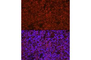 Immunofluorescence (IF) image for anti-PYD and CARD Domain Containing (PYCARD) (AA 50-195) antibody (ABIN3021617)