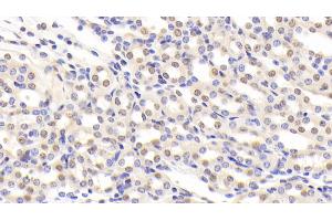 Detection of NCL in Mouse Kidney Tissue using Polyclonal Antibody to Nucleolin (NCL)