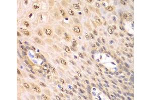 Immunohistochemistry of paraffin-embedded Human esophagus using PSMA2 Polyclonal Antibody at dilution of 1:100 (40x lens).
