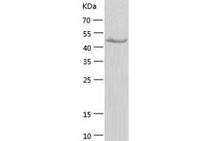 Western Blotting (WB) image for Inositol Hexakisphosphate Kinase 1 (IP6K1) (AA 1-441) protein (His tag) (ABIN7288176) (IP6K1 Protein (AA 1-441) (His tag))