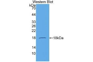Western blot analysis of the recombinant protein. (CCL21 antibody  (AA 24-134))