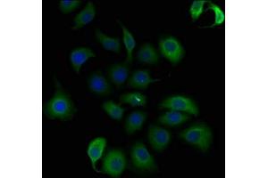 Immunofluorescence staining of A549 cells with ABIN7140197 at 1:50, counter-stained with DAPI. (Trichohyalin antibody  (AA 1922-1941))