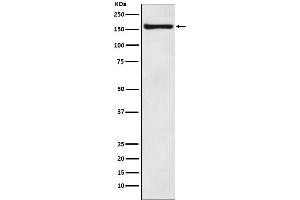 Western blot analysis of COPA expression in MCF7 cell lysate.