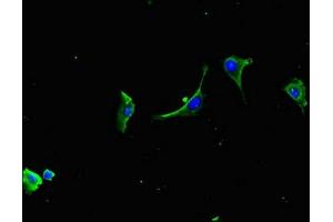 Immunofluorescent analysis of U251 cells using ABIN7158030 at dilution of 1:100 and Alexa Fluor 488-congugated AffiniPure Goat Anti-Rabbit IgG(H+L) (LZTFL1 antibody  (AA 116-299))