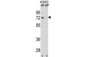 Western blot analysis of ESR1 isoform1 Antibody (C-term) Pab (ABIN1881317 and ABIN2838677) pre-incubated without(lane 1) and with(lane 2) blocking peptide in K562 cell line lysate. (Estrogen Receptor alpha antibody  (C-Term))