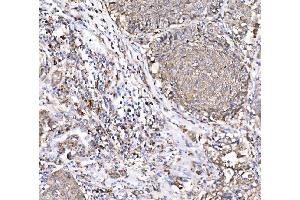 IHC analysis of PAK1 using anti-PAK1 antibody (ABIN7599852).