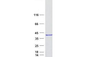 HMGCLL1 Protein (Transcript Variant 2) (Myc-DYKDDDDK Tag)