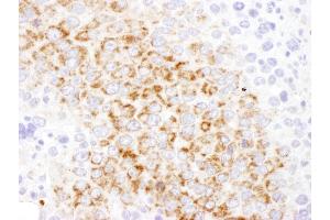 Immunohistochemistry (IHC) image for anti-Glutamic-Oxaloacetic Transaminase 2, Mitochondrial (Aspartate Aminotransferase 2) (GOT2) (AA 380-430) antibody (ABIN7454581)
