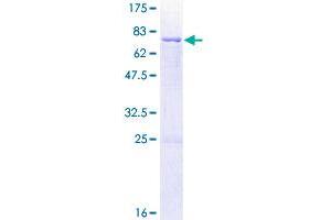 Image no. 1 for Carboxypeptidase M (CPM) (AA 1-443) protein (GST tag) (ABIN1350194)