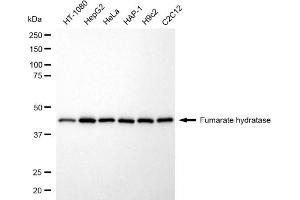 Western blotting analysis using fumarate hydratase antibody (ABIN7798665). (FH antibody)