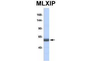 Western Blotting (WB) image for anti-MLX Interacting Protein (MLXIP) (Middle Region) antibody (ABIN2776519)