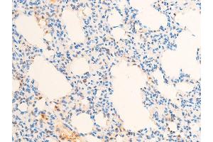 ABIN6267307 at 1/100 staining rat lung tissue sections by IHC-P.