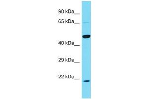 Host: Rabbit Target Name: KRT25 Sample Type: PANC1 Whole Cell lysates Antibody Dilution: 1. (Keratin 25 antibody  (C-Term))