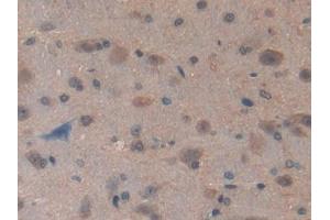 Used in DAB staining on fromalin fixed paraffin- embedded kidney tissue (GCLC antibody  (AA 435-636))