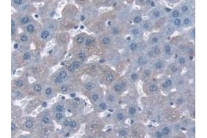Detection of NQO1 in Mouse Liver Tissue using Polyclonal Antibody to NADH Dehydrogenase, Quinone 1 (NQO1) (NQO1 antibody  (AA 2-274))