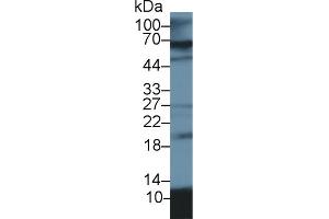 Western Blot; Sample: Porcine Lung lysate; Primary Ab: 2µg/ml Rabbit Anti-Porcine S100A12 Antibody Second Ab: 0. (S100A12 antibody  (AA 2-92))