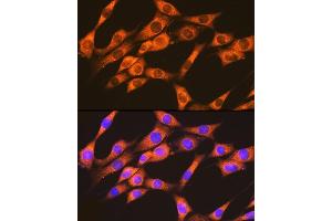Immunofluorescence analysis of NIH-3T3 cells using RA + RB Rabbit mAb (ABIN7269853) at dilution of 1:100 (40x lens). (RAP1A + RAP1B antibody)