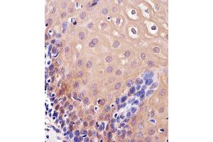 Immunohistochemical analysis of paraffin-embedded H. (TXN antibody  (C-Term))