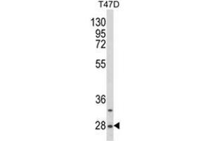 Western blot analysis of SNRPB Antibody (N-term R49) Cat. (SNRPB antibody  (N-Term))