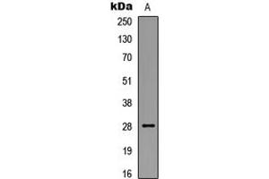 Western blot analysis of BCL2 (pS87) expression in HEK293T UV-treated (A) whole cell lysates. (Bcl-2 antibody  (pSer87))