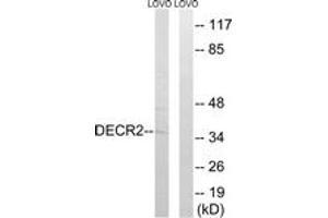 Western blot analysis of extracts from LOVO cells, using DECR2 Antibody. (DECR2 antibody  (AA 217-266))