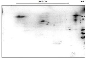 2D SDS-PAGE and WB of PARP1 OVCAR-8 Wild Type Lysate separated on 2D SDS-PAGE and blotted on PVDF to analyze immunocoverage of PARP1 antibody specific for the autocatalytic domain of PARP1. (PARP1 antibody  (C-Term))