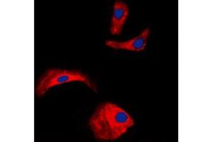 Immunofluorescent analysis of OLFML2A staining in HepG2 cells. (OLFML2A antibody  (Center))