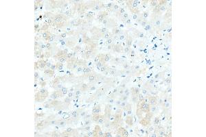 Immunohistochemistry of paraffin-embedded Human liver (negative control sample) using IGHD antibody (ABIN7267824) at dilution of 1:100 (40x lens).