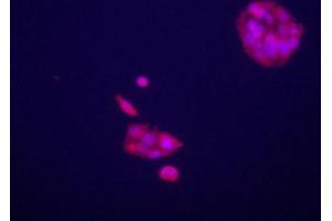 Immunofluorecence staining of anti-GPC3 Pab on HepG2 cells.