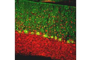 Immunofluorescent analysis of rat cerebellum section stained with chicken pAb to calbindin, ABIN8126692, dilution 1:2,000, in green, and costained with rabbit pAb to MeCP2, dilution 1:5,000, in red. (CALB1 antibody)