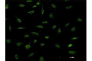 Immunofluorescence (IF) image for anti-FOS-Like Antigen 2 (FOSL2) (AA 207-296) antibody (ABIN560944)
