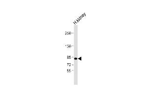 Anti-VAV3 Antibody (Cterm) at 1:2000 dilution + human kidney lysate Lysates/proteins at 20 μg per lane. (VAV3 antibody  (C-Term))