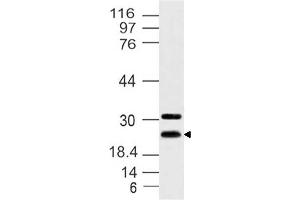 Image no. 1 for anti-Hairy and Enhancer of Split 7 (HES7) antibody (ABIN5027718) (HES7 antibody)