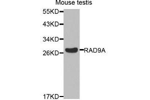 Western blot analysis of extracts of mouse testis, using RAD9A antibody. (RAD9A antibody  (AA 162-391))