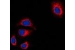 Immunofluorescent analysis of Focal Adhesion Kinase staining in HT29 cells. (FAK antibody  (C-Term))