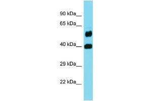 Western Blotting (WB) image for anti-Folate Hydrolase 1B (FOLH1B) (Middle Region) antibody (ABIN2436969) (FOLH1B antibody  (Middle Region))
