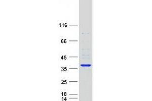 Validation with Western Blot