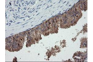 Image no. 5 for anti-Chromosome 2 Open Reading Frame 62 (C2orf62) antibody (ABIN1497054) (C2orf62 antibody)