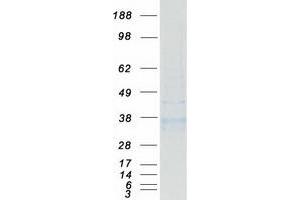 Western Blotting (WB) image for Hydroxysteroid (11-Beta) Dehydrogenase 1 (HSD11B1) (Transcript Variant 1) protein (Myc-DYKDDDDK Tag) (ABIN2715551)