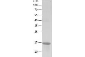 Western Blotting (WB) image for Eukaryotic Translation Initiation Factor 4E Binding Protein 2 (EIF4EBP2) (AA 1-120) protein (His tag) (ABIN7122852) (eIF4EBP2 Protein (AA 1-120) (His tag))