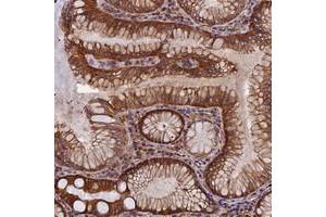 Immunohistochemical staining of human stomach with EHBP1L1 polyclonal antibody  shows strong cytoplasmic positivity in glandular cells. (EHBP1L1 antibody)