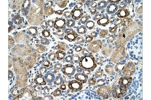 ST14 antibody was used for immunohistochemistry at a concentration of 4-8 ug/ml. (ST14 antibody)