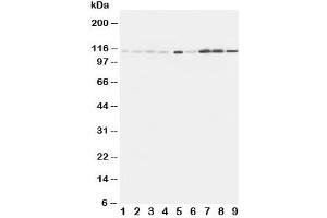 Western Blotting (WB) image for anti-Ephrin Type A Receptor 1 (EPHA1) (C-Term) antibody (ABIN3030829)