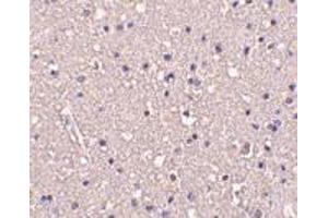 Immunohistochemistry of CRMP1 in human brain tissue with CRMP1 antibody at 10 μg/ml. (CRMP1 antibody  (Intermediate Domain))