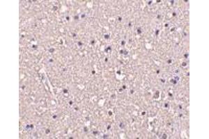 Immunohistochemistry of CRMP1 in human brain tissue with CRMP1 antibody at 10 μg/ml.