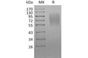 Western Blotting (WB) image for Lysosomal-Associated Membrane Protein 1 (LAMP1) protein (His tag) (ABIN7320804) (LAMP1 Protein (His tag))