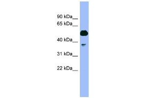 WB Suggested Anti-PSMC4 Antibody Titration: 0. (PSMC4 antibody  (N-Term))