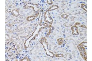 Immunohistochemistry of paraffin-embedded rat kidney using ITGAV antibody. (CD51 antibody)