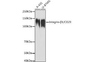 Western blot analysis of extracts of various cell lines, using Integrin-β1/CD29 antibody (ABIN6134032, ABIN6142578, ABIN6142579 and ABIN6219452) at 1:1000 dilution. (ITGB1 antibody  (AA 600-700))