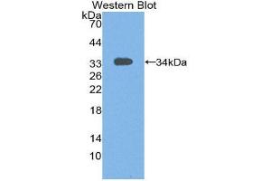 Western Blotting (WB) image for anti-Signal Transducing Adaptor Molecule (SH3 Domain and ITAM Motif) 1 (STAM) (AA 199-464) antibody (ABIN2117575) (STAM antibody  (AA 199-464))